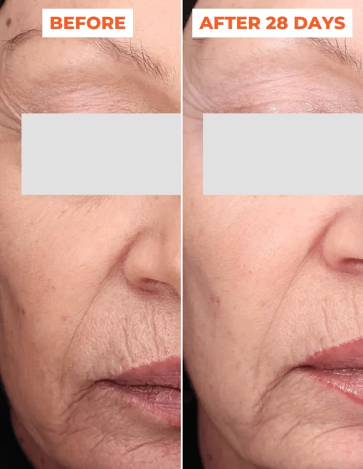 Bộ đôi thay da sinh học DermEden Advanced Peel: Tinh chất trước thay da (Pre-Peel) và Tinh chất thay da (Peel)