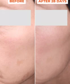 Bộ đôi thay da sinh học DermEden Advanced Peel: Tinh chất trước thay da (Pre-Peel) và Tinh chất thay da (Peel)