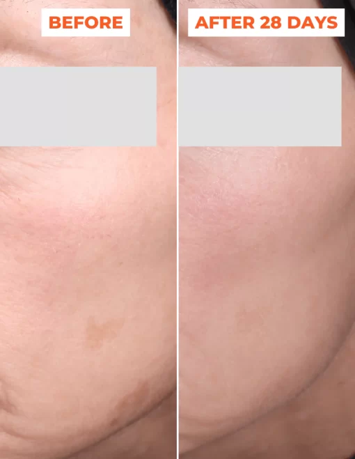 Bộ đôi thay da sinh học DermEden Advanced Peel: Tinh chất trước thay da (Pre-Peel) và Tinh chất thay da (Peel)