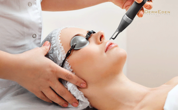 Chăm sóc da đúng cách sau các liệu pháp thẩm mỹ (laser, peel da, phi kim,...)