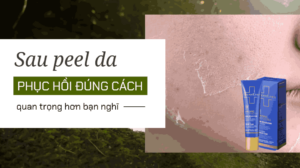 Sau peel da, phục hồi đúng cách quan trọng hơn bạn nghĩ