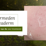Kem phục hồi da Dermeden Cicaderm: làm dịu, tái tạo da sau treatment