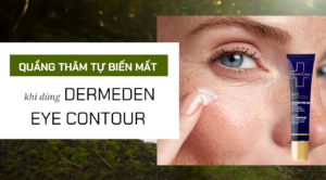 Quầng thâm không tự biến mất – trừ khi bạn dùng Kem dưỡng mắt DermEden Eye Contour 1