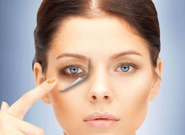 Quầng thâm không tự biến mất – trừ khi bạn dùng Kem dưỡng mắt DermEden Eye Contour 1
