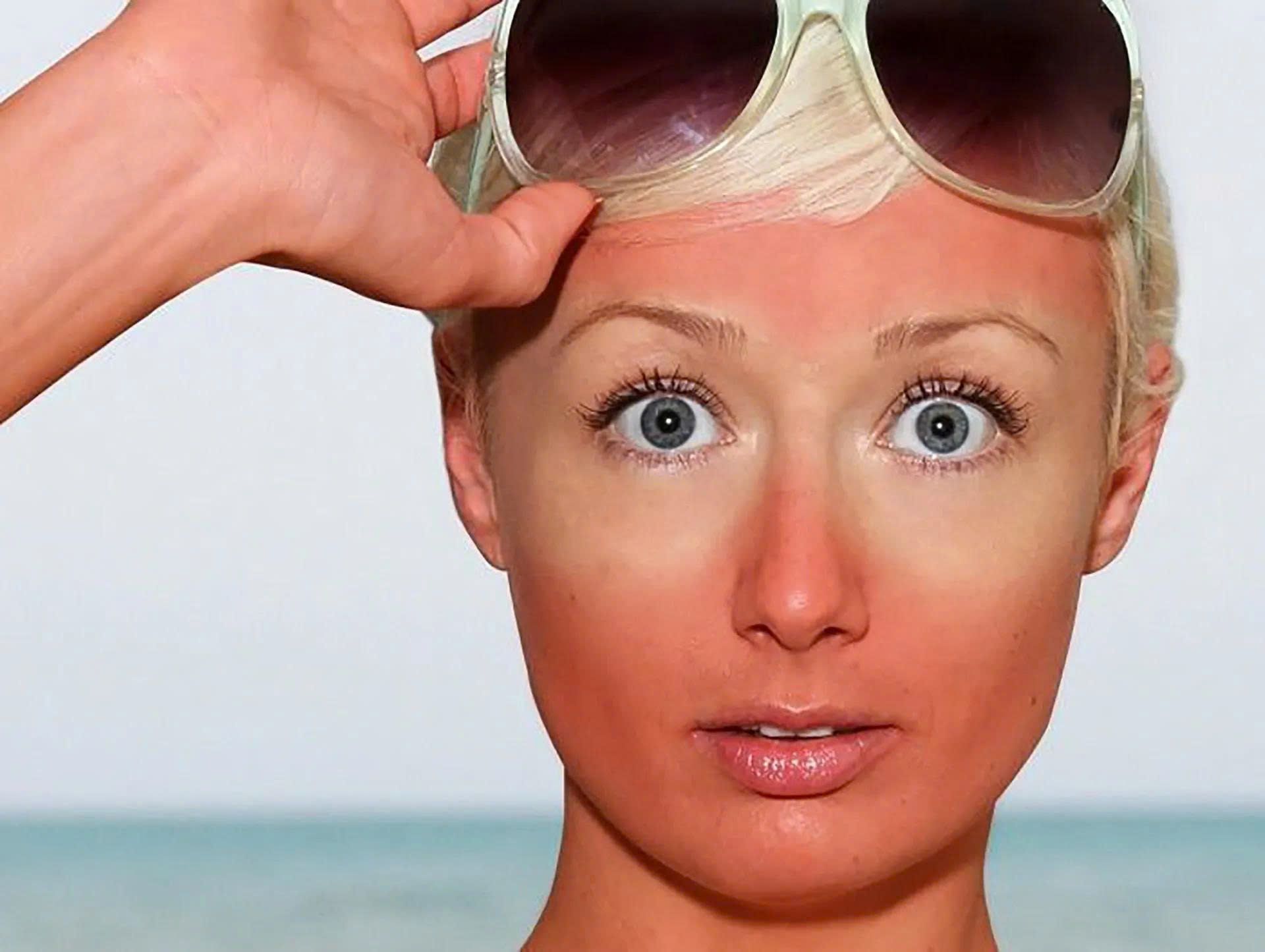 3-causes-of-sensitive-skin-a-science-backed-recovery-routine-from-nzheal-4