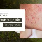 3-thu-pham-khien-da-nhay-cam-va-goi-y-routine-phuc-hoi-khoa-hoc-tu-living-nature